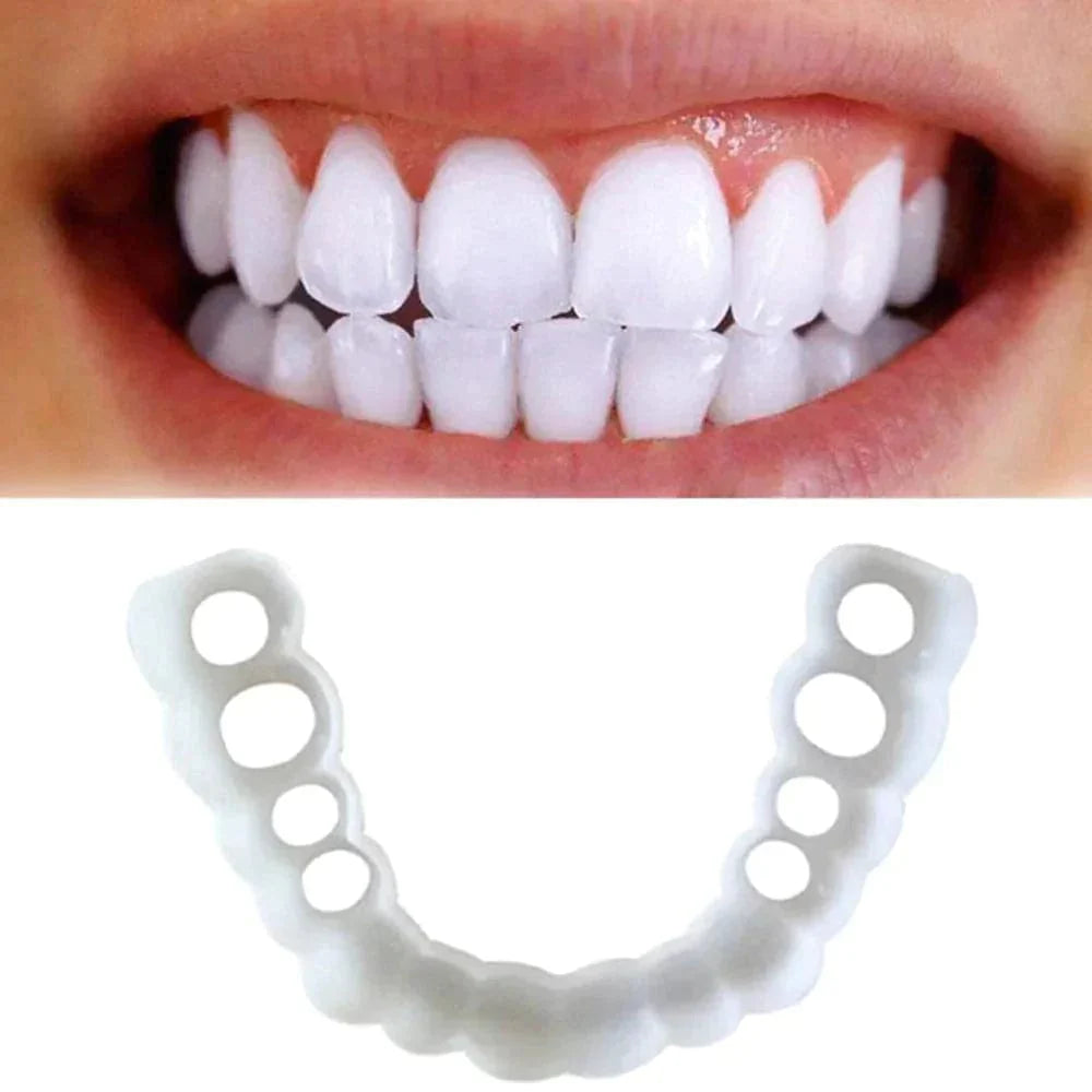 New Snap on smile